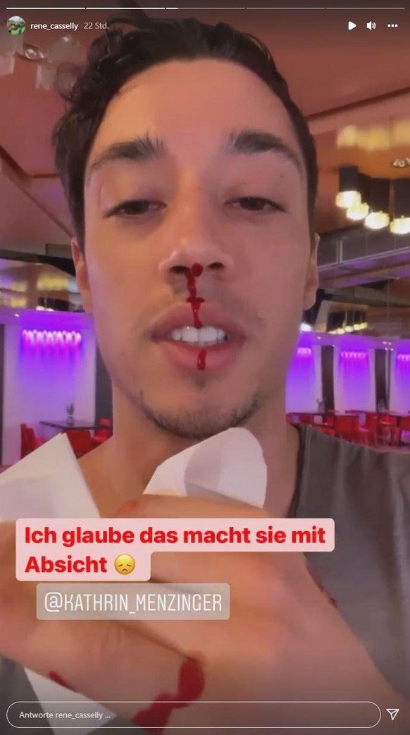 René Casselly scheint sich im "Let's Dance"-Training verletzt zu haben.