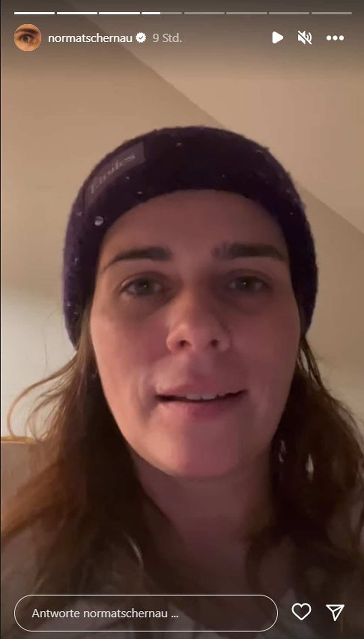 Nora Tschirner gibt auf Instagram ein Update nach ihrer Verletzung.