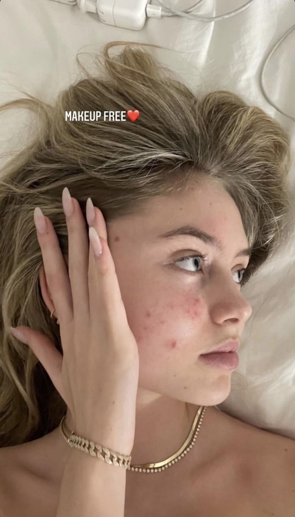 Leni Klum zeigt sich in ihrer Instagram-Story ganz ohne Filter und Make-Up.