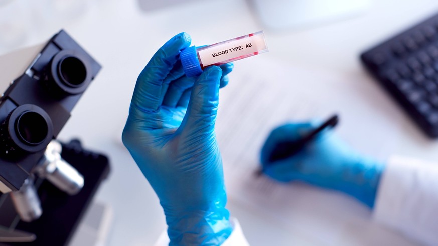 wissenschaft,notizen,blutgruppe,ab,blutprobe,blutuntersuchung,wissenschaften,memo,notiz,blutgruppen,ab jetzt,hernieder,herunter,hinunter,von,blutproben,bluttest,untersuchen,untersuchung ** science,not ...