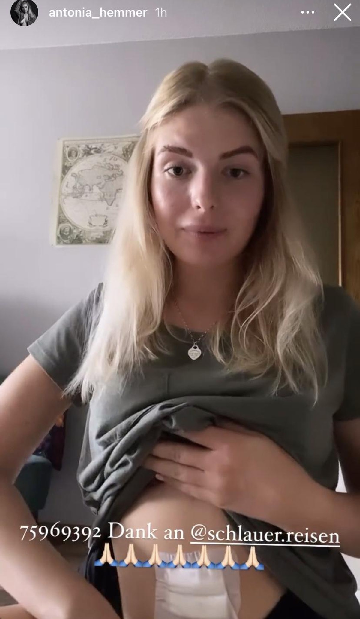 Auch ihre Wunden am Bauch zeigte sie ihren Fans.