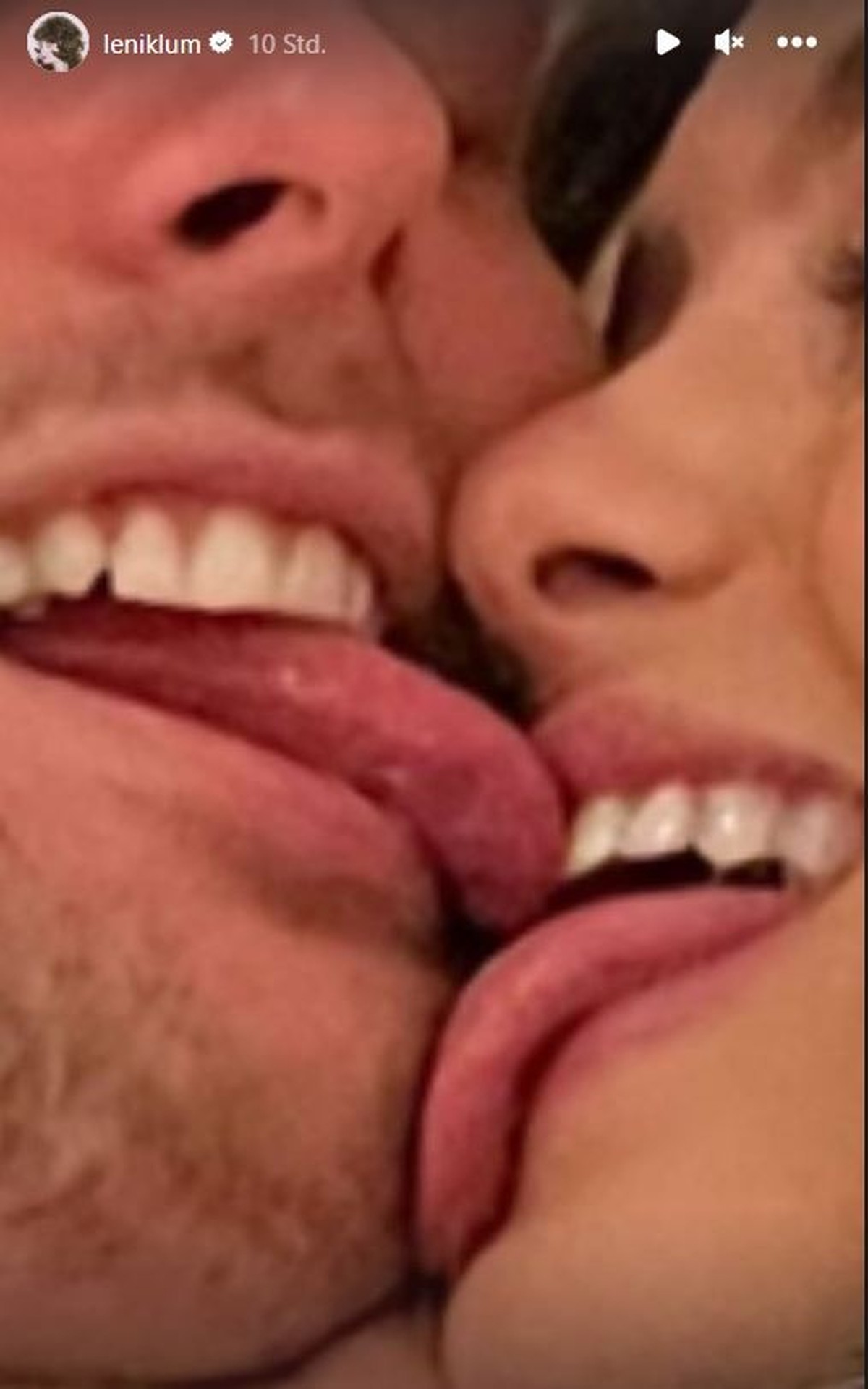 Dieses Foto hat die 19-Jährige in ihrer Insta-Story gepostet.