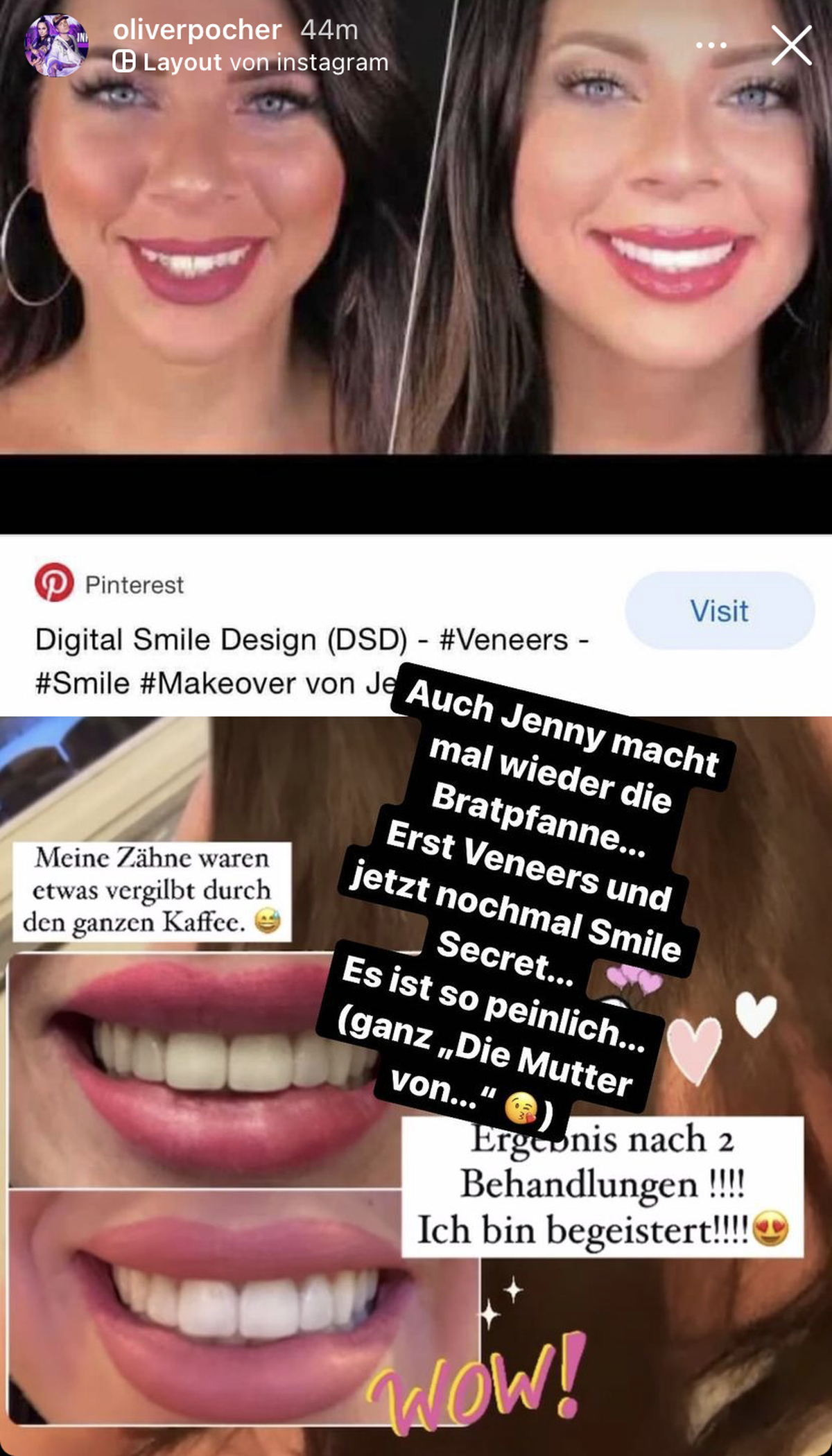 Oliver Pocher setzte prompt sein Statement dazu.