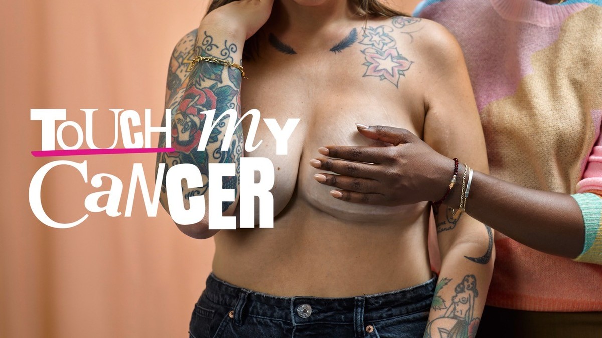 Touch my cancer, buusenkollektiv