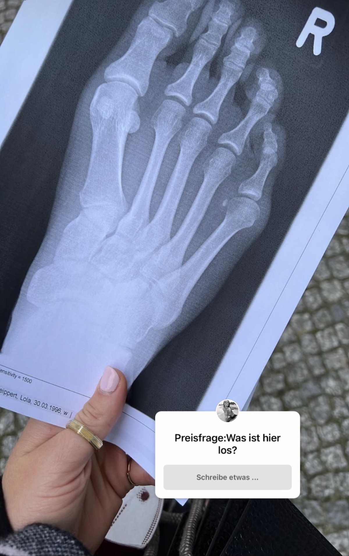 Lola Weippert zeigt ihren Followern ihre "unschönen" Füße.