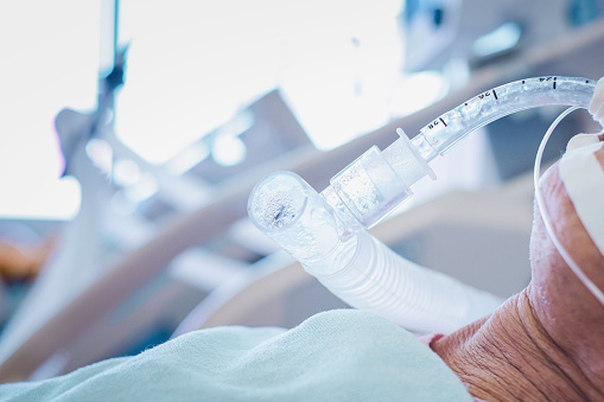 Weaning off Endotrachel tube giving oxygen to human