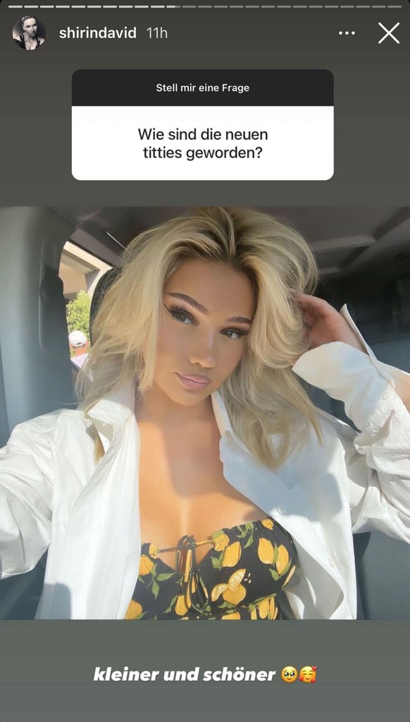 Shirin David zeigte das Ergebnis ihrer Brust-OP.