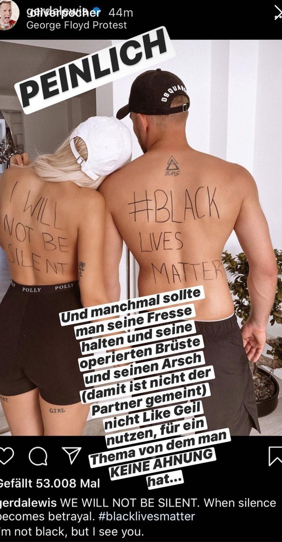 Gerda Lewis mit ihrem Freund: Die beiden zeigen auf ihrem Rücken ihre Botschaft im Kampf gegen Rassismus.