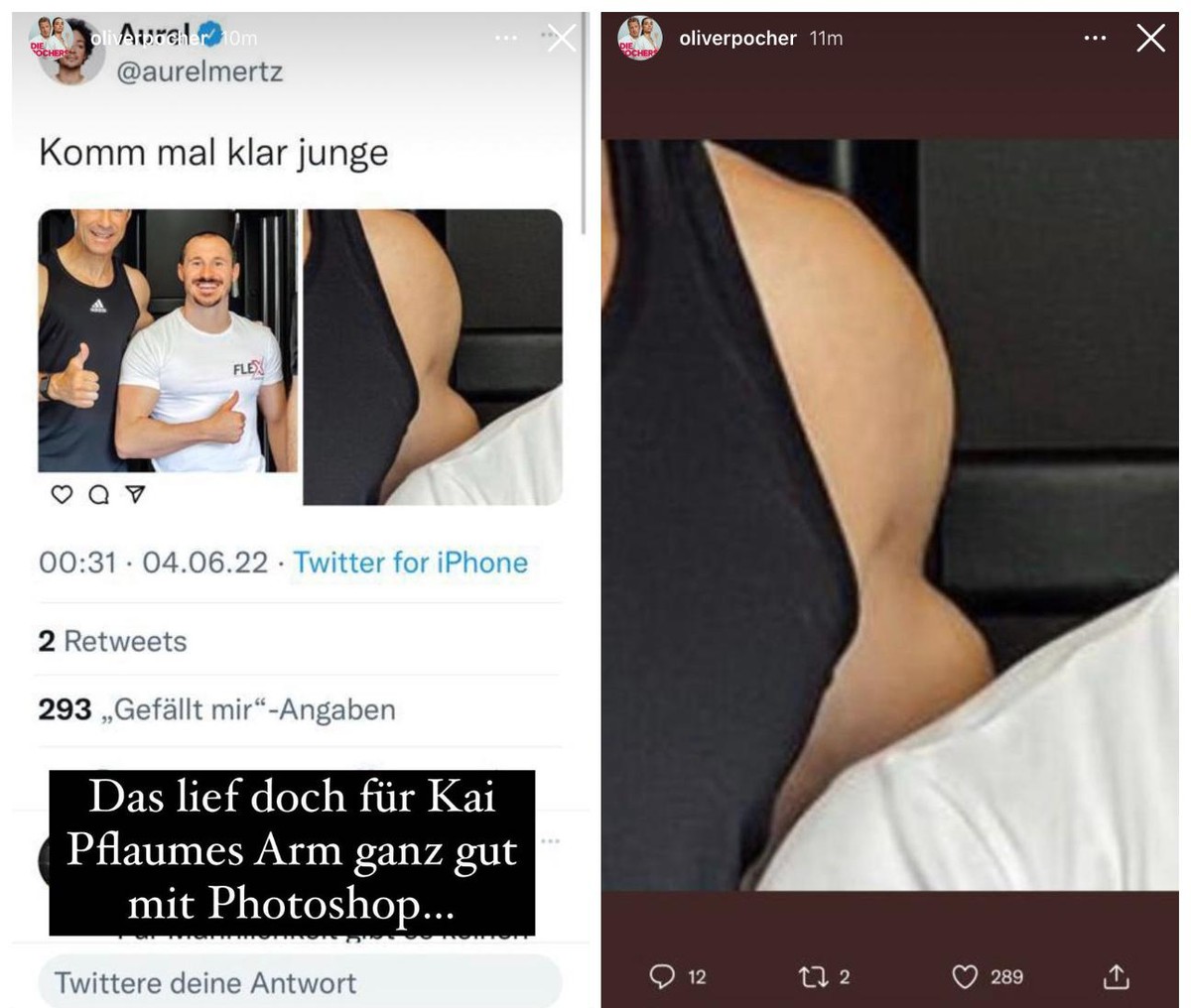 Hier zeigte Pocher den Arm von Pflaume vom Nahen.