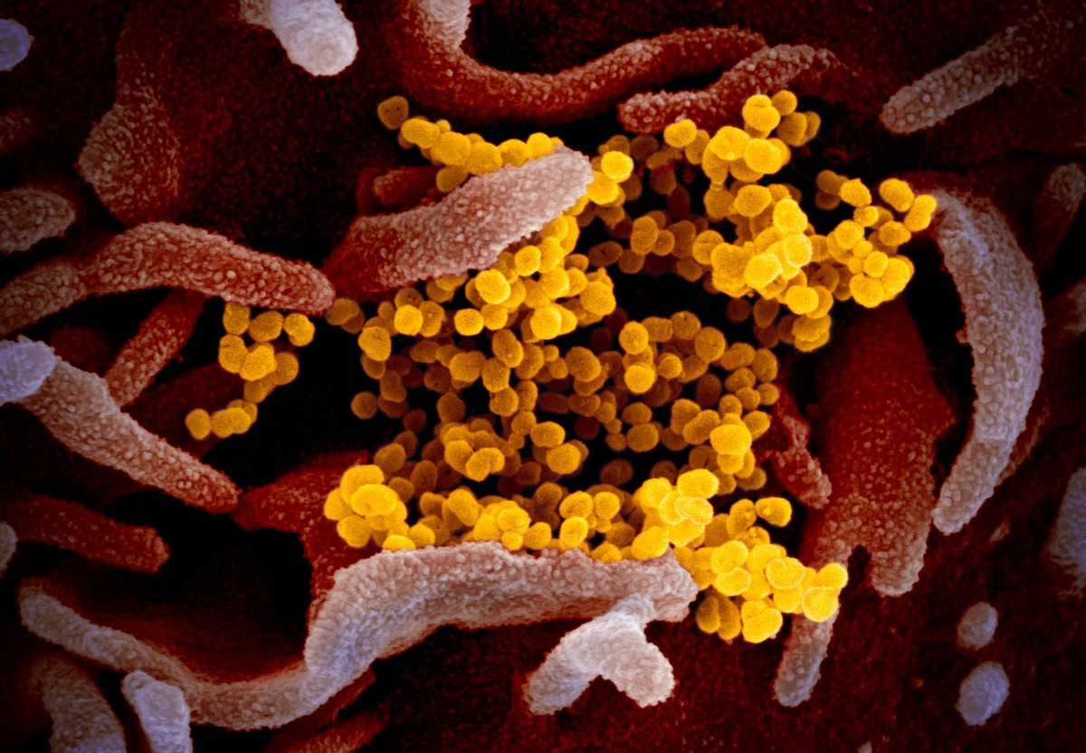 This scanning electron microscope image shows SARS-CoV-2 also known as 2019-nCoV, the virus that causes COVID-19isolated from a patient in the U.S., emerging from the surface of cells cultured in the ...