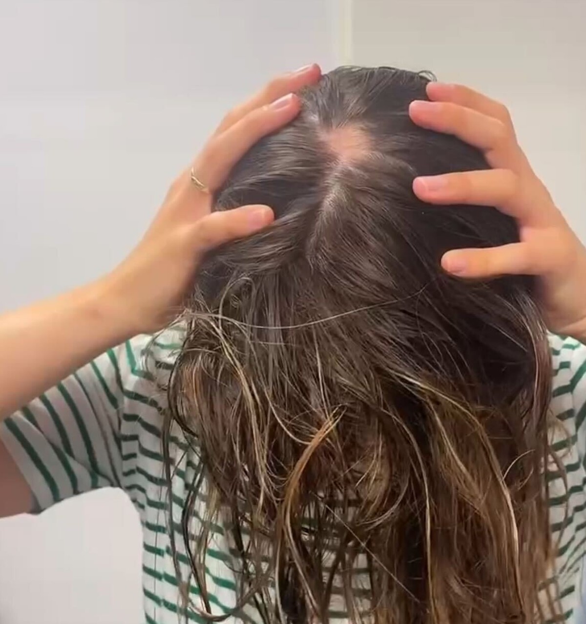 Dieses Bild entstand an dem Tag, als ich den Haarausfall das erste Mal bemerkte.