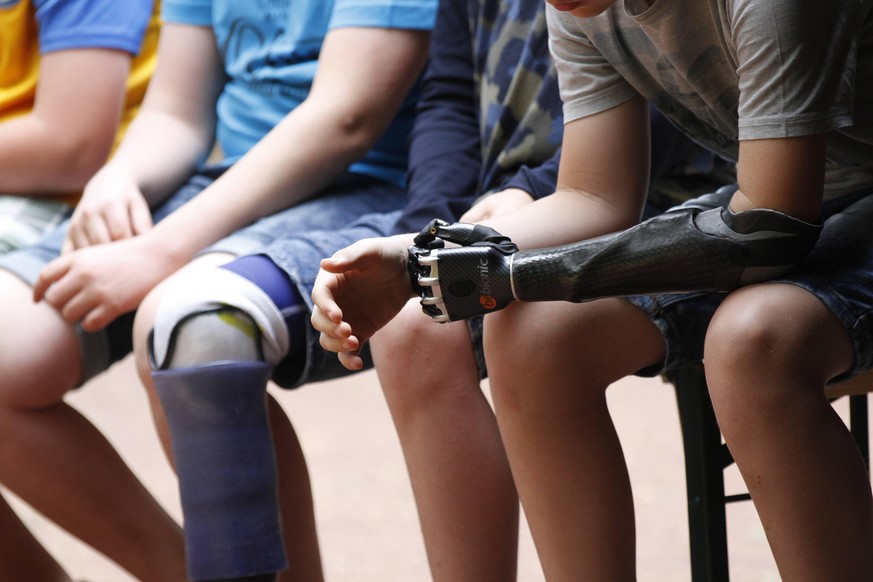 Virtual-Reality-Spiele sollen jungen Patienten helfen, den Umgang mit der Prothese spielerisch zu erlernen.