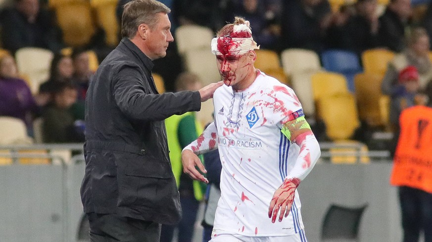 October 19, 2017 - Kyiv, Ukraine - Head coach Oleksandr Khatskevych (L) of FC Dynamo Kyiv supports defender Domagoj Vida who sustained a head injury during the UEFA Europa League Group B match against ...