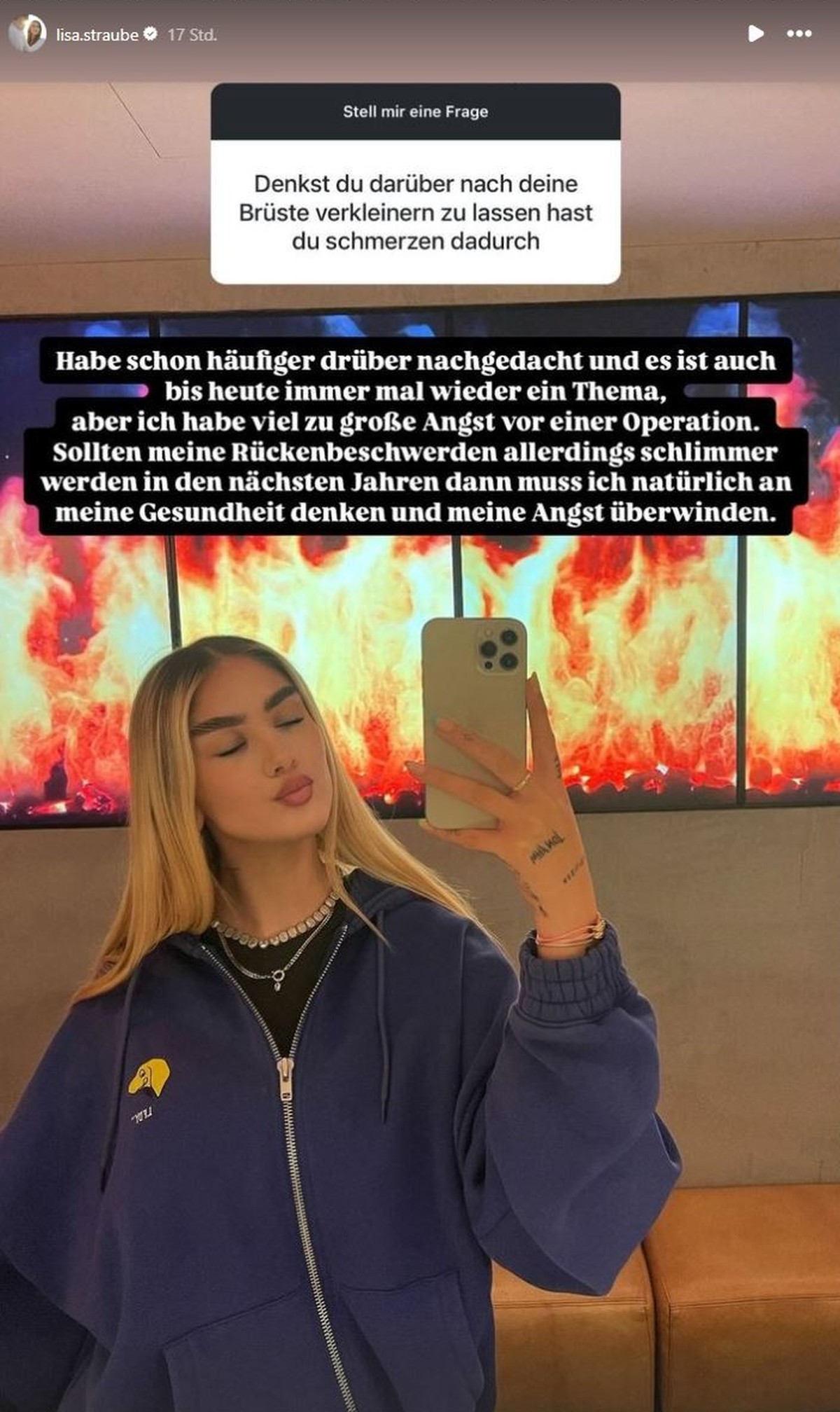 So denkt Lisa Straube über eine Brustverkleinerung.