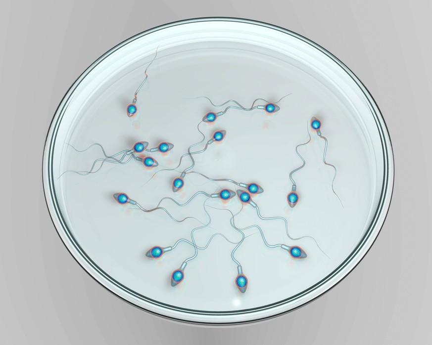 In vitro fertilization concept illustration In vitro fertilization concept Computer illustration showing spermatozoans in a petri dish waiting to be used to fertilize an egg cell PUBLICATIONxINxGERxSU ...