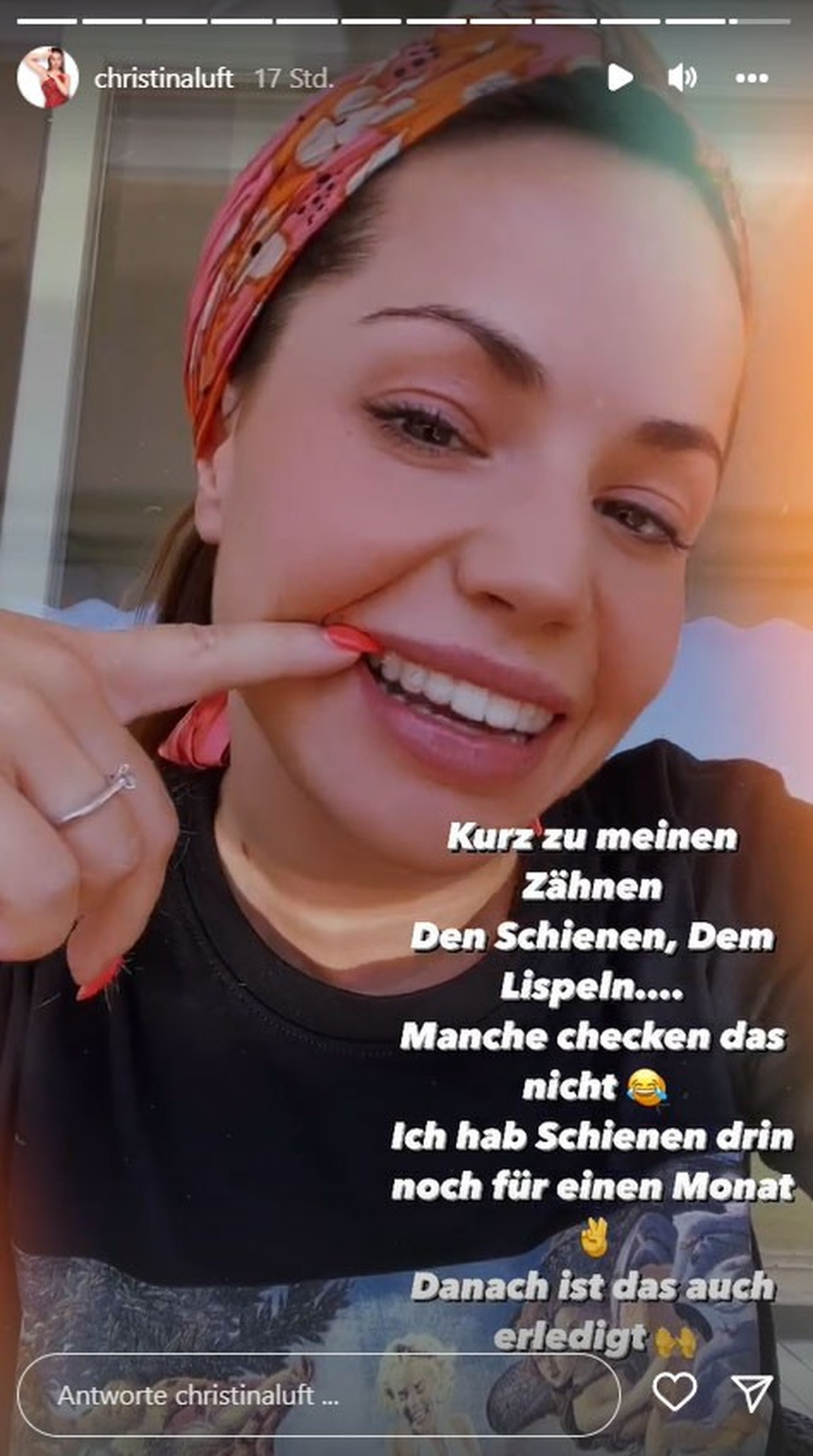 Christina Lufts Invisaligns sorgten bei einigen Fans offenbar für Verwirrung.