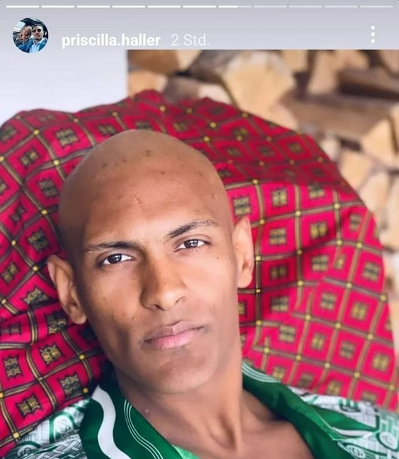 Sébastien Haller verlor durch die Chemotherapie seine Haare.