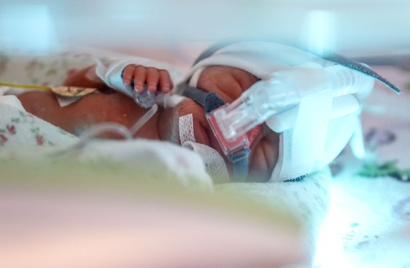 One of the quintuplets, which were born in the University Hospital, is seen in an incubator. Krakow, Poland on February 14, 2023. Three girls and two boys were born in the 28th week of pregnancy by ca ...