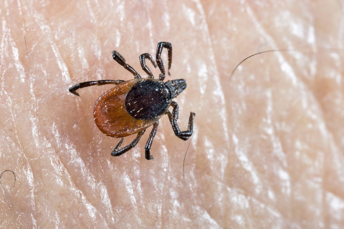 Zecke, Gemeiner Holzbock Ixodes ricinus, sitzt auf menschlicher Haut, Deutschland European castor bean tick, European sheep tick Ixodes ricinus, sits on human skin, Germany BLWS656524 *** Tick, common ...