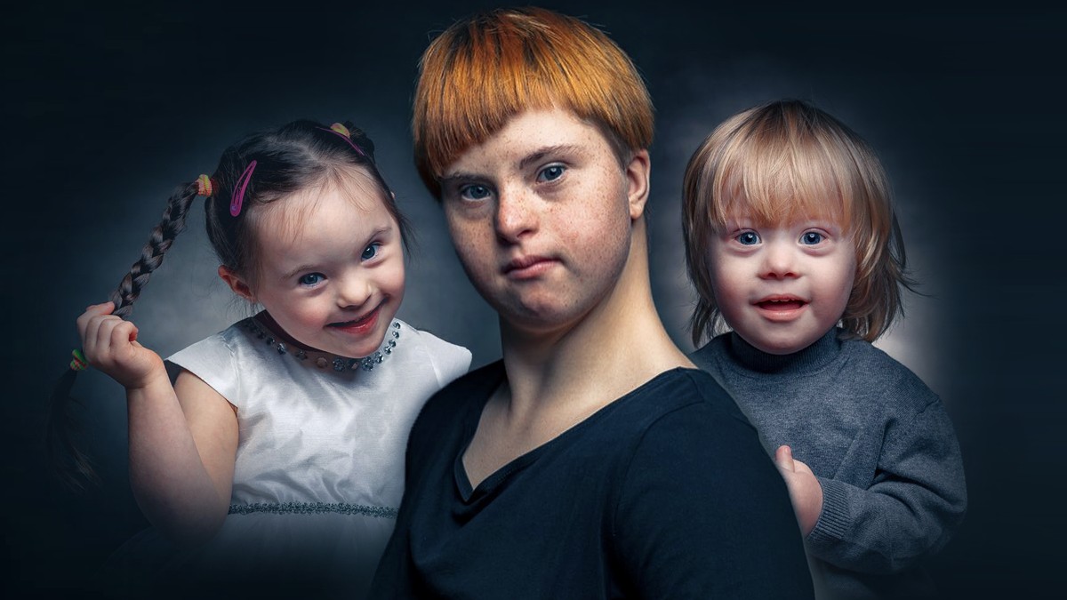 Er fotografiert Kinder mit DownSyndrom "Sieh uns mit anderen Augen