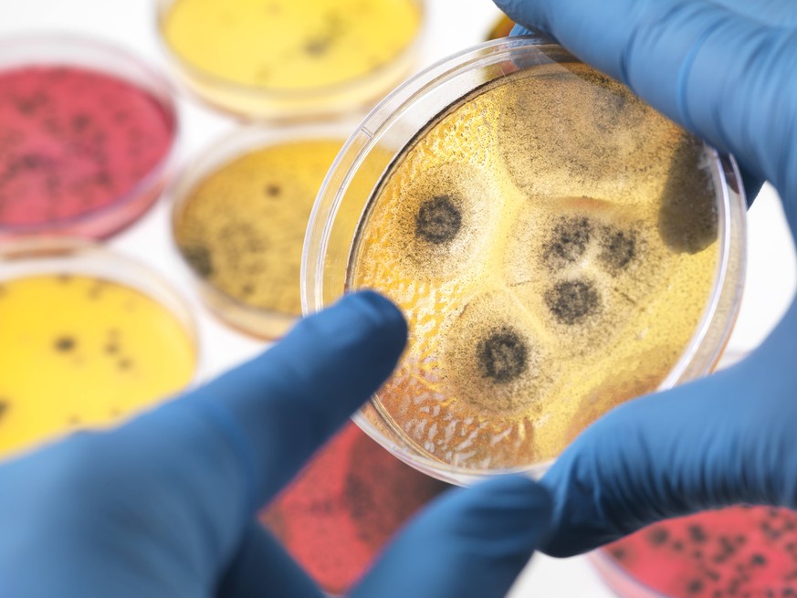 Scientist examining petri dishes containing bacterial growth in the laboratory model released Symbolfoto property released PUBLICATIONxINxGERxSUIxAUTxHUNxONLY ABRF00342