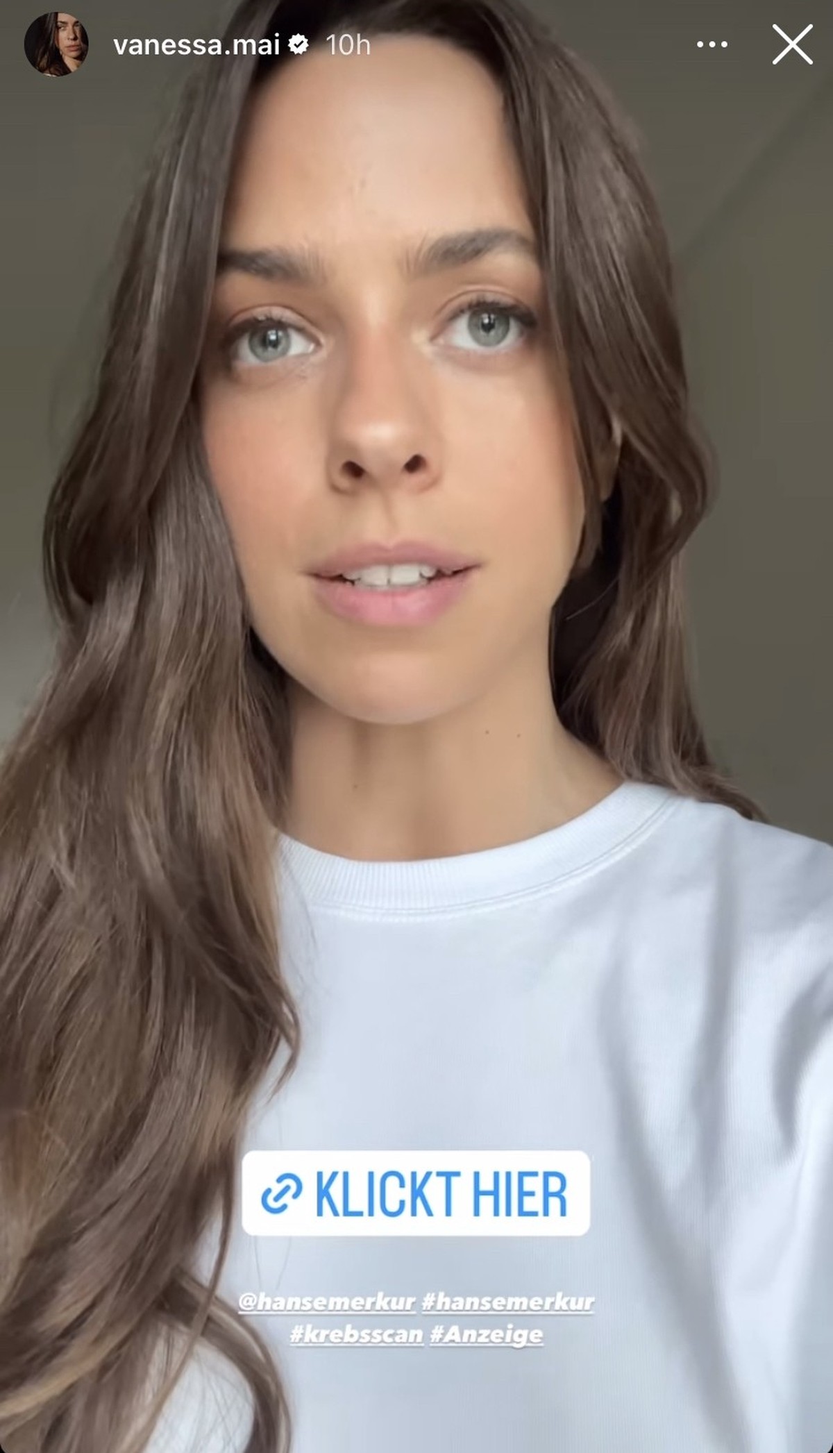 Vanessa Mai machte auf ein wichtiges Thema aufmerksam.