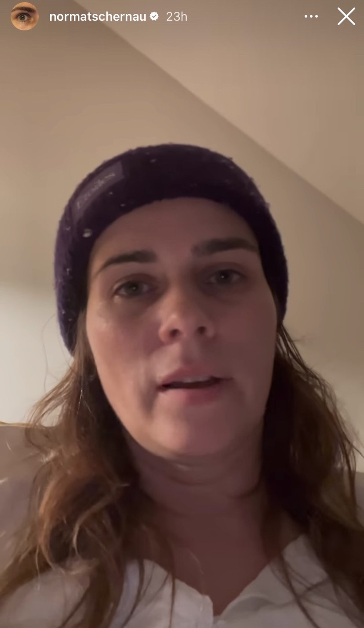 Nora Tschirner äußerte sich vor wenigen Tagen selbst zu dem Unfall.