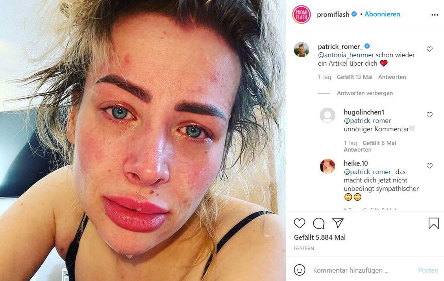 Dsds Aline Bachmann Geschlagen Und Bedroht