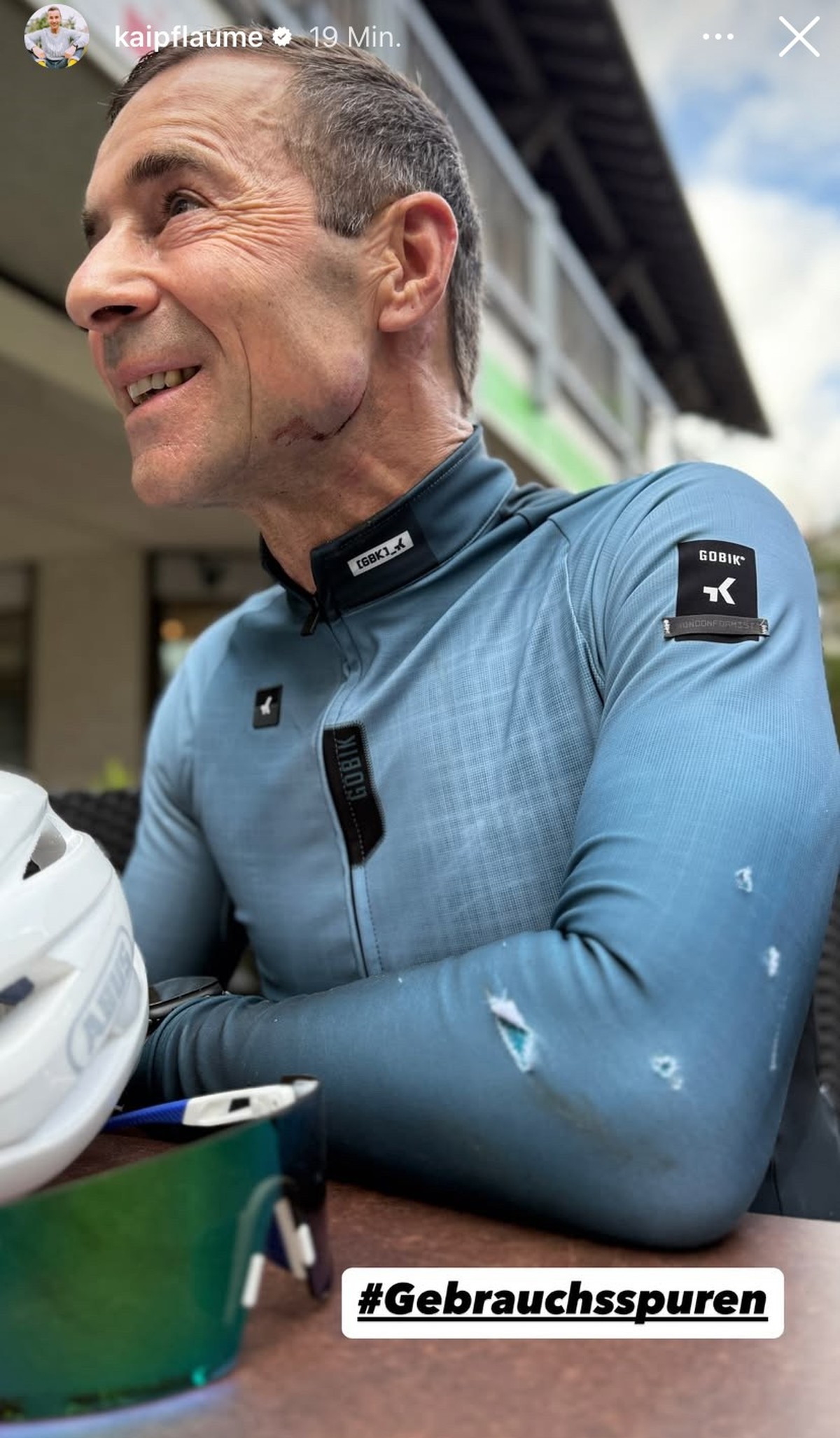 Kai Pflaume zeigt sein kaputtes Trikot und seine Wunde im Gesicht.