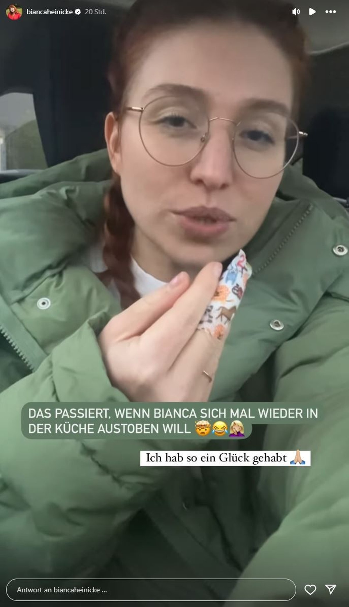 Bianca Heinicke zeigt ihre Verletzung am Finger.