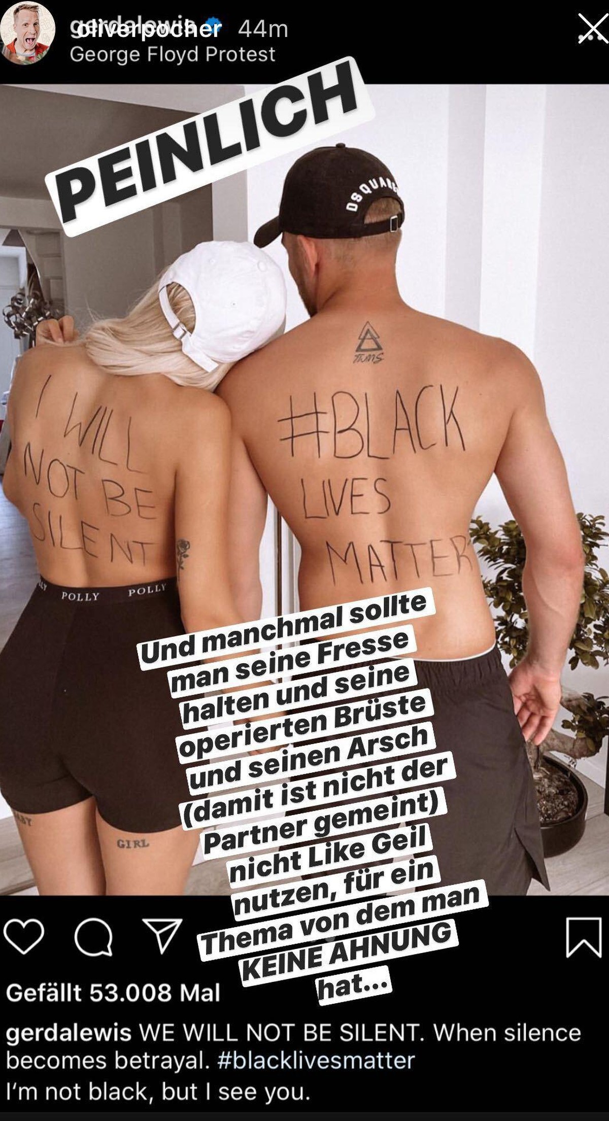 Gerda Lewis mit ihrem Freund: Die beiden zeigen auf dem Rücken ihre Botschaft im Kampf gegen Rassismus.