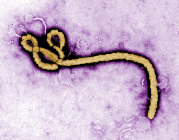 FILE - In this undated colorized transmission electron micrograph file image made available by the CDC shows an Ebola virus virion. Congo&#039;s Ebola outbreak has spread to a city, the capital of the ...