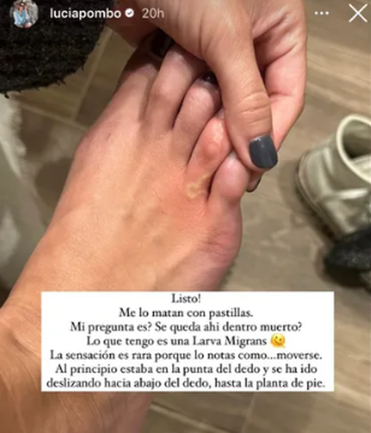 Die Influencerin berichtet auf Instagram von ihrer Infektion.
