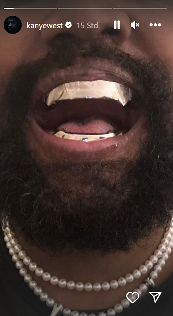 Kanye West zeigt Metall-Zähne auf Instagram.