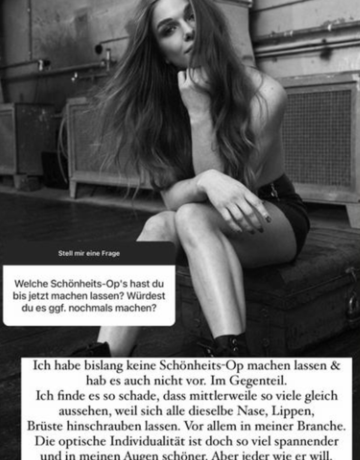 Lola Weippert hat eine klare Meinung zu Schönheits-OPs.