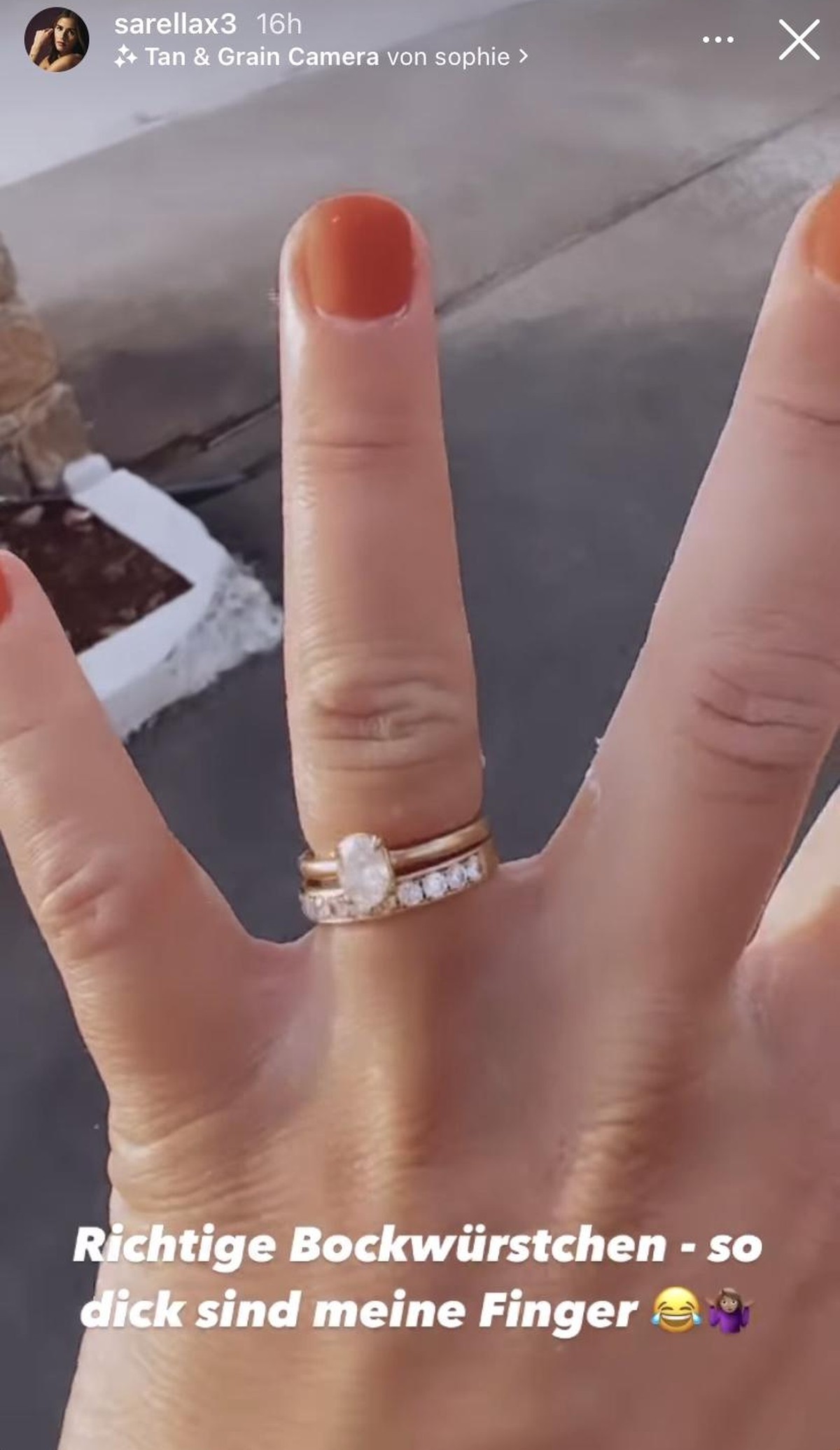 Hier zeigte die Sängerin ihre geschwollenen Finger.