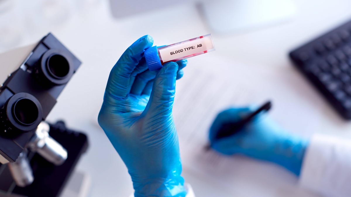 wissenschaft,notizen,blutgruppe,ab,blutprobe,blutuntersuchung,wissenschaften,memo,notiz,blutgruppen,ab jetzt,hernieder,herunter,hinunter,von,blutproben,bluttest,untersuchen,untersuchung ** science,not ...