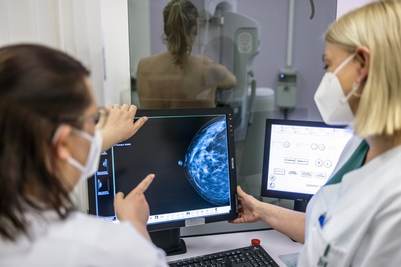 ARCHIV - 25.02.2022, Berlin: Medizinisches Personal untersucht mit einer Mammografie die Brust einer Frau auf Brustkrebs. Im Kampf gegen steigende Zahlen von Krebserkrankungen weltweit muss die Pr�ven ...