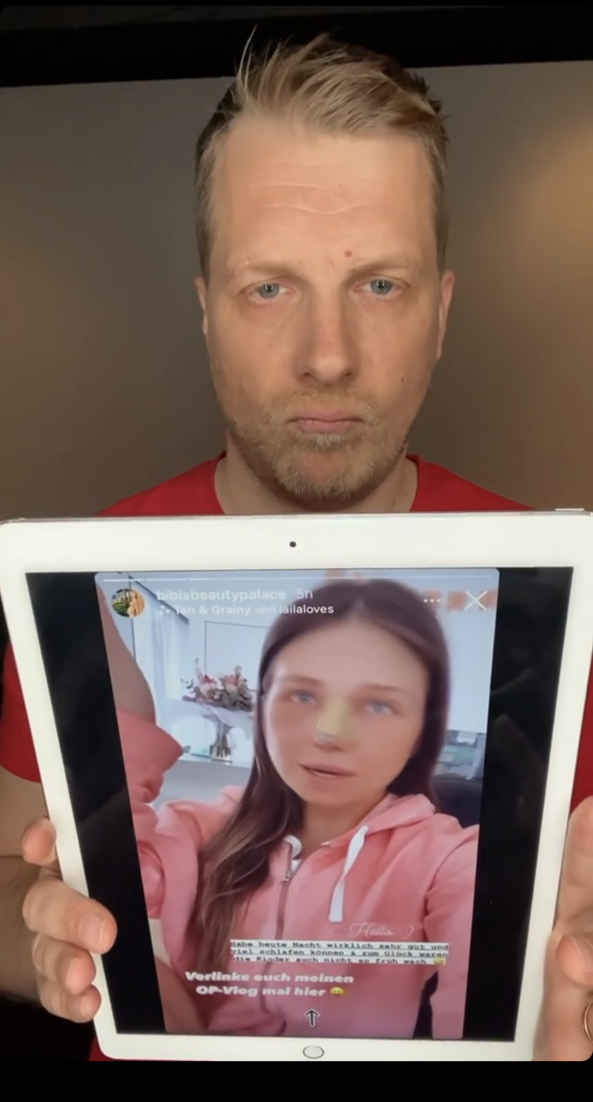 Oliver Pocher zeigt, was Bibi nach den Eingriffen zu erzählen hat.