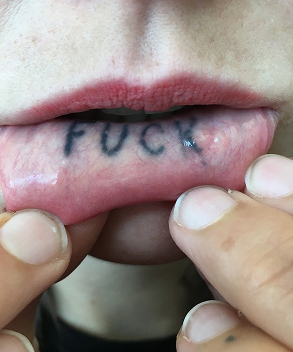 first image