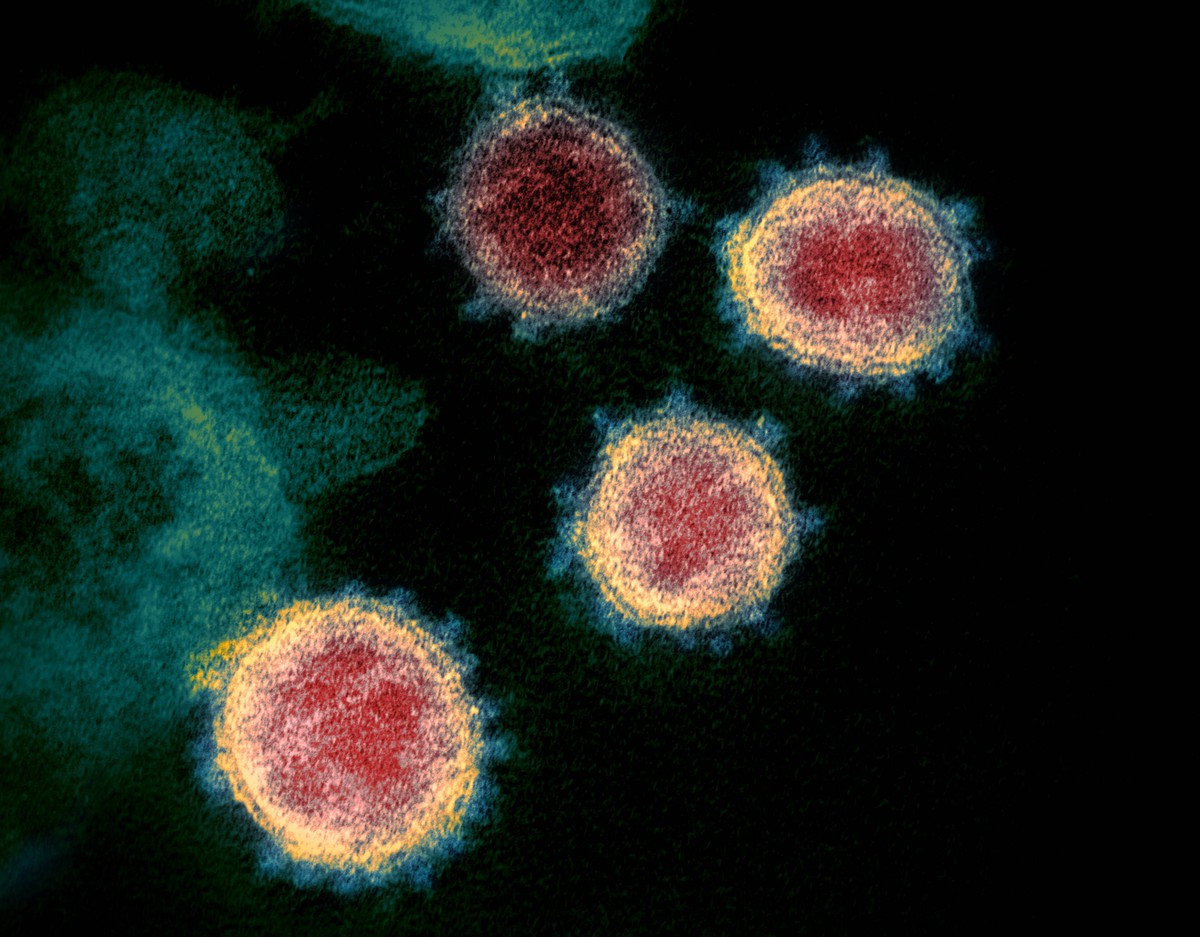 This transmission electron microscope image shows SARS-CoV-2also known as 2019-nCoV, the virus that causes COVID-19isolated from a patient in the U.S. Virus particles are shown emerging from the surfa ...