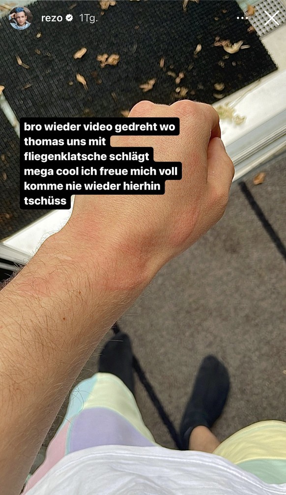 Rezo zeigt seinen Unterarm in seiner Instagram-Story.