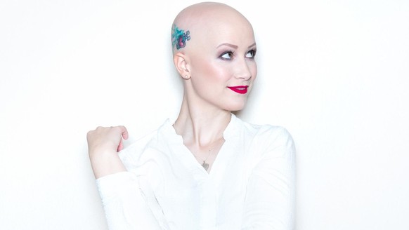Kristina Rau betreibt die Instagram-Plattform "Alopecia Gesichter".