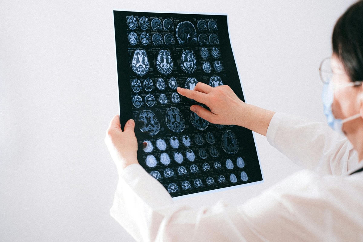Hirntumor x-ray