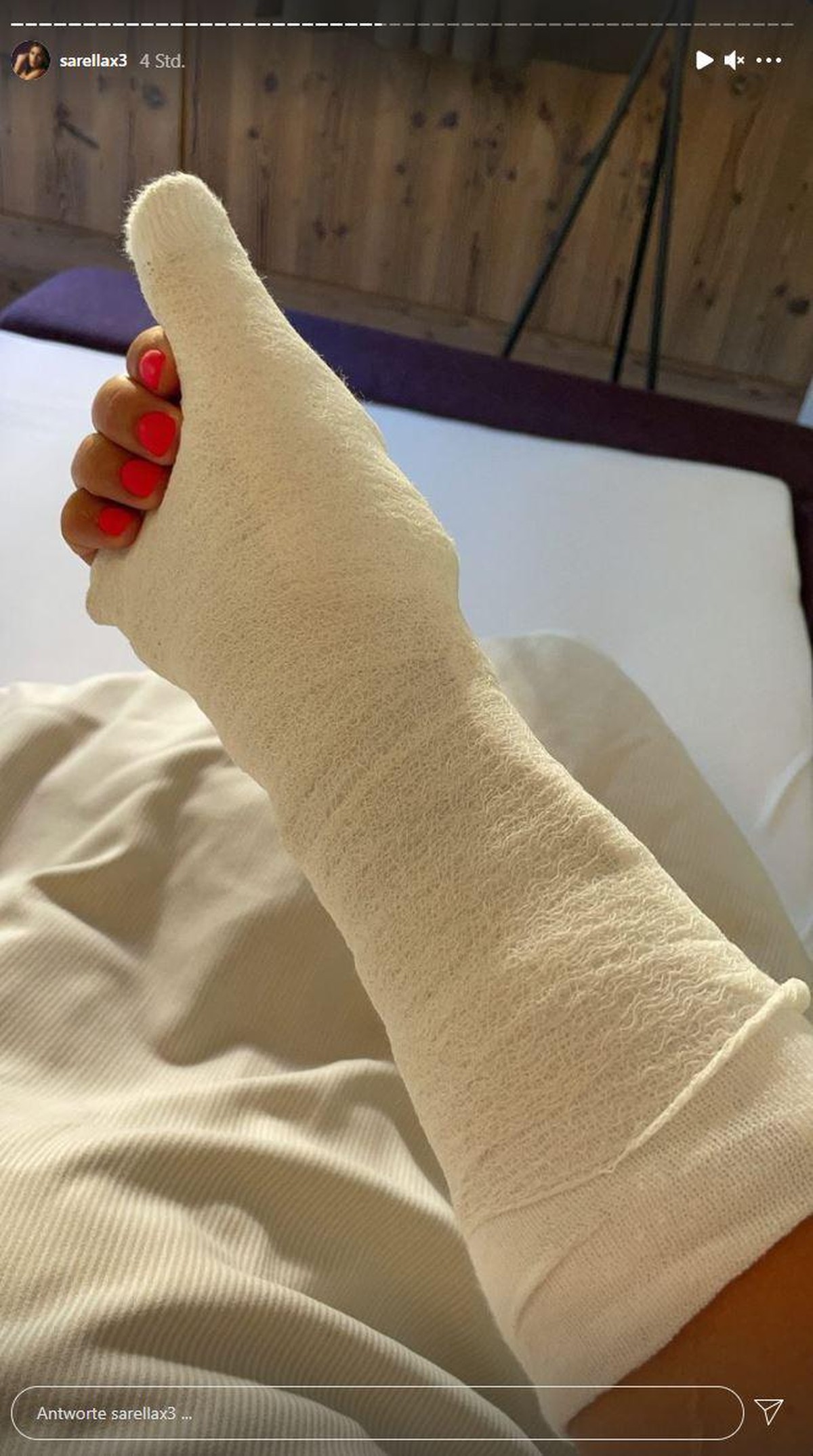 Sarahs eingegipster Arm.