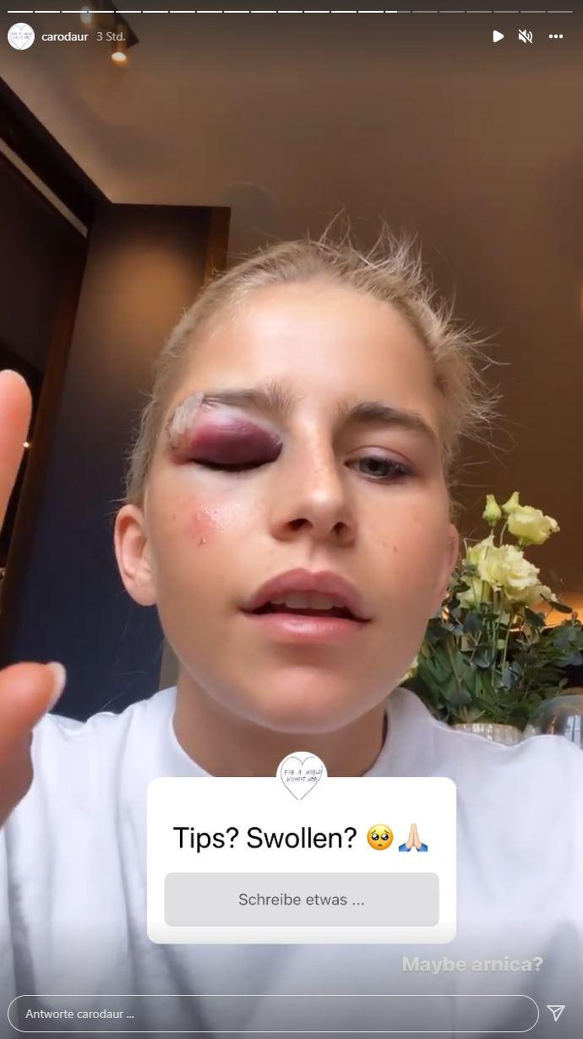 Influencerin holt sich Tipps gegen die Schwellung.