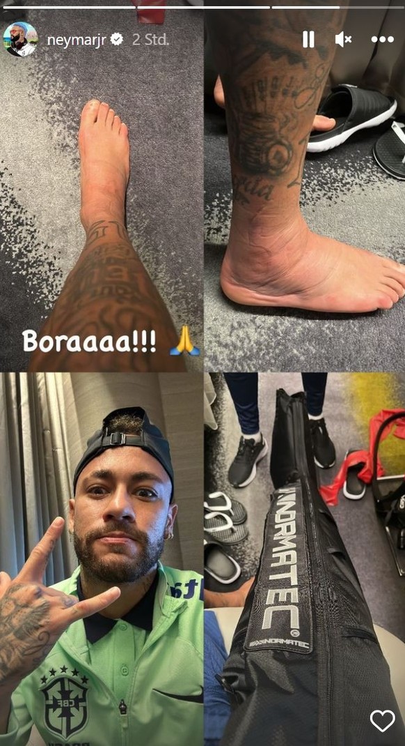 Neymar zeigt auf Instagram seinen geschwollenen Knöchel.