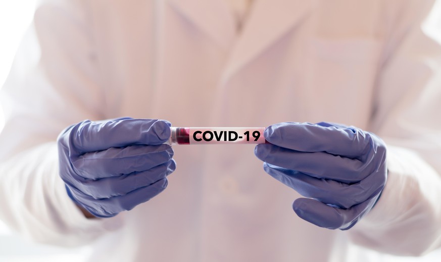 Eine Blutprobe, die auf das Coronavirus getestet wurde.