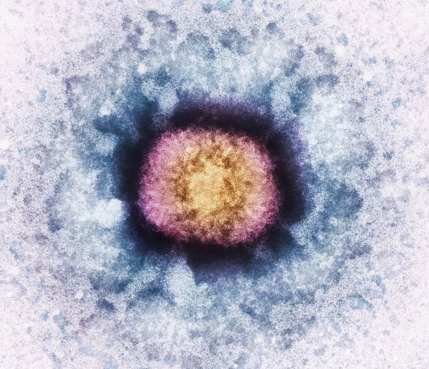 Vaccinia virus particle, TEM Vaccinia virus particle (VV), coloured transmission electron micrograph (TEM). VV is composed of a DNA (deoxyribonucleic acid) core (orange), surrounded by a protein coat  ...