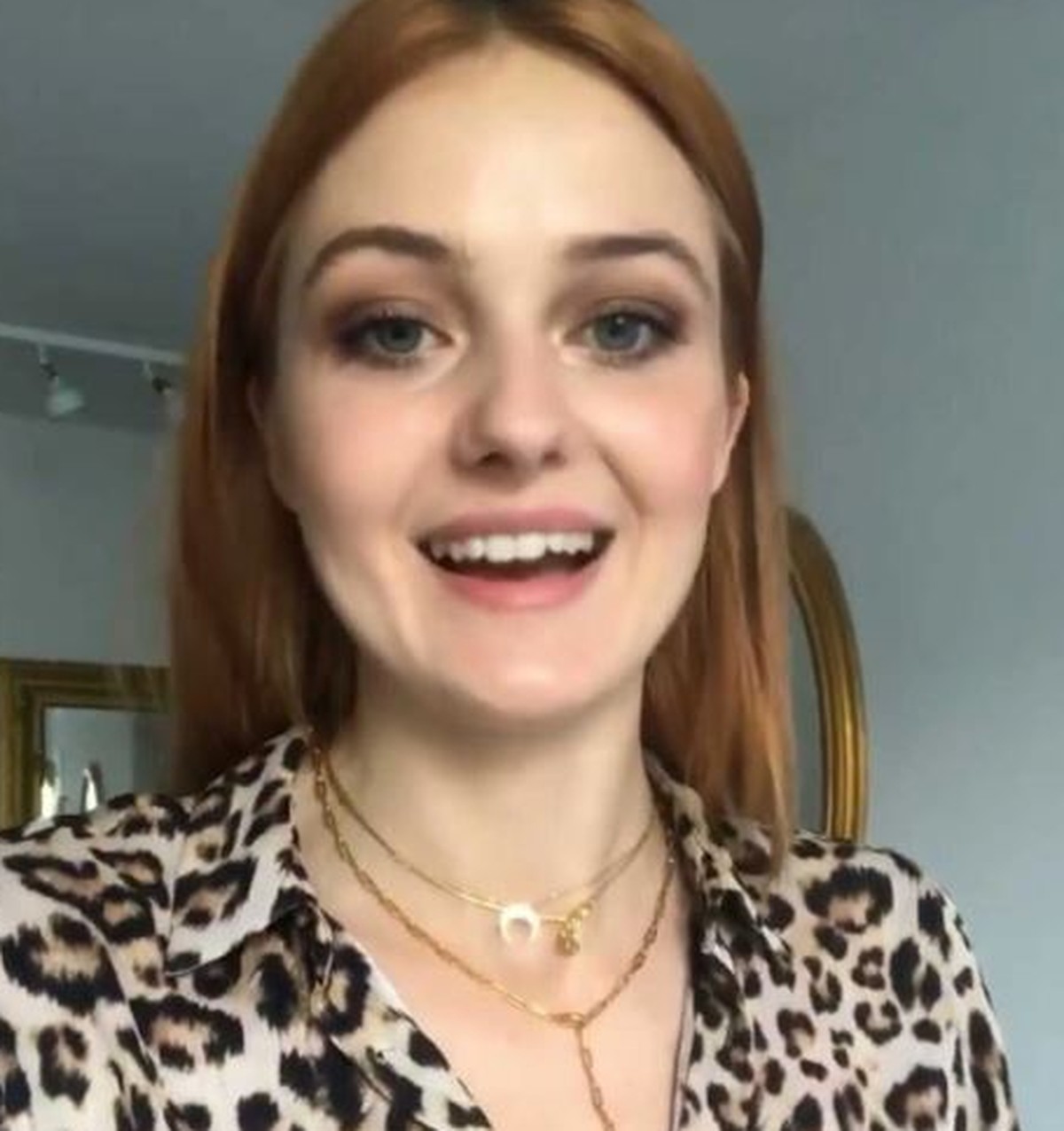 Vanessa Stanat: So sah das Model vor einem Jahr noch aus.